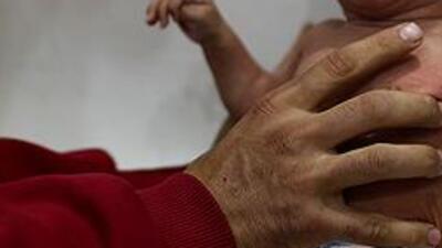 BM: Doğu Guta'da yetersiz beslenen çocukların sayısı ürkütücü boyutlarda