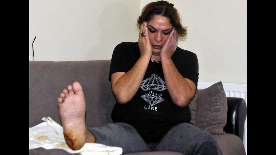 15 yıl önce ayağına taş battı, sonrası korkunç!