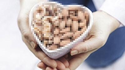 'Sağlıklı' diye avuç avuç yiyoruz! Meğer en büyük kanserojen onların içindeymiş!