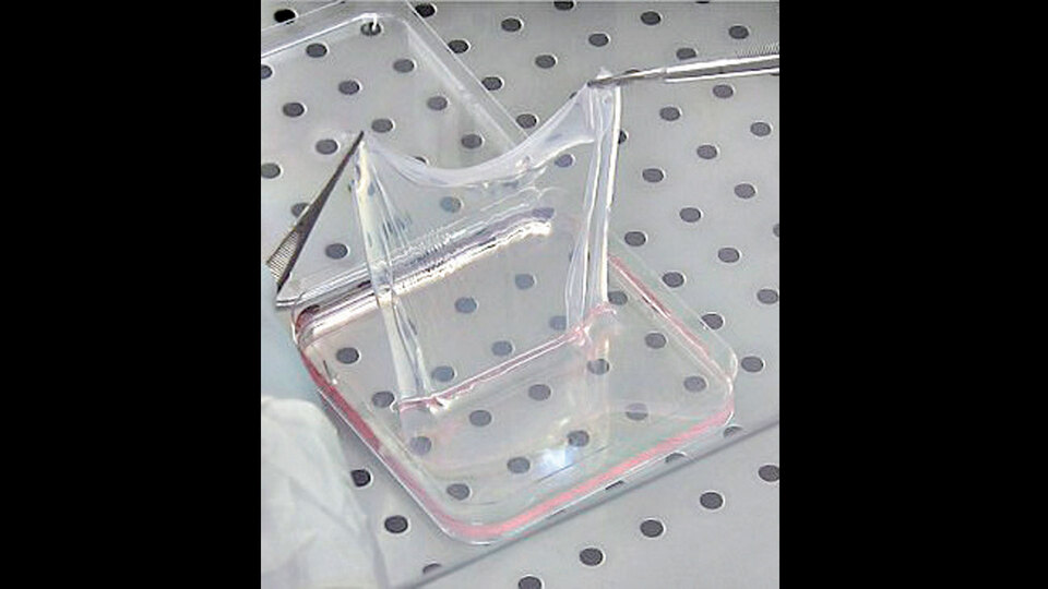 Yapay zekâ kanseri tedavi edecek