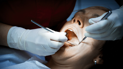 Diş problemi o şansı yakalamanızı bile engelleyebilir!