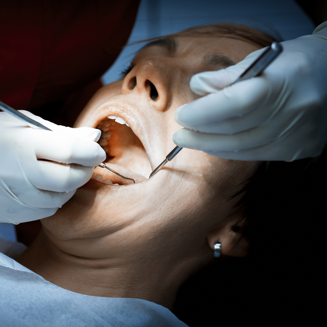 Diş problemi o şansı yakalamanızı bile engelleyebilir!