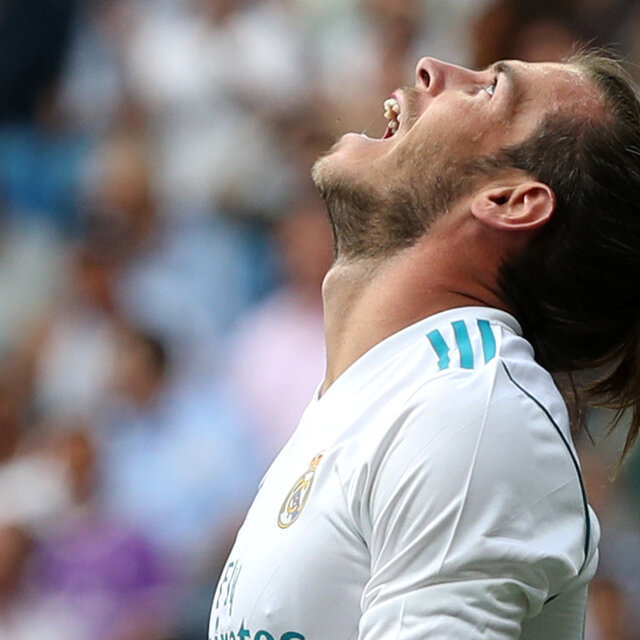Gareth Bale 24. kez sakatlandı!