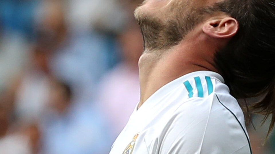 Gareth Bale 24. kez sakatlandı!