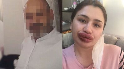 Mahkemeden karar çıktı! İşte sahte botoksçunun cezası