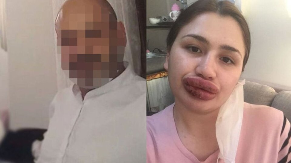 Mahkemeden karar çıktı! İşte sahte botoksçunun cezası