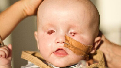 Dünyası kapkaranlık! Gözleri görmüyor, kulakları duymuyor!