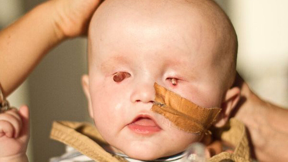 Dünyası kapkaranlık! Gözleri görmüyor, kulakları duymuyor!