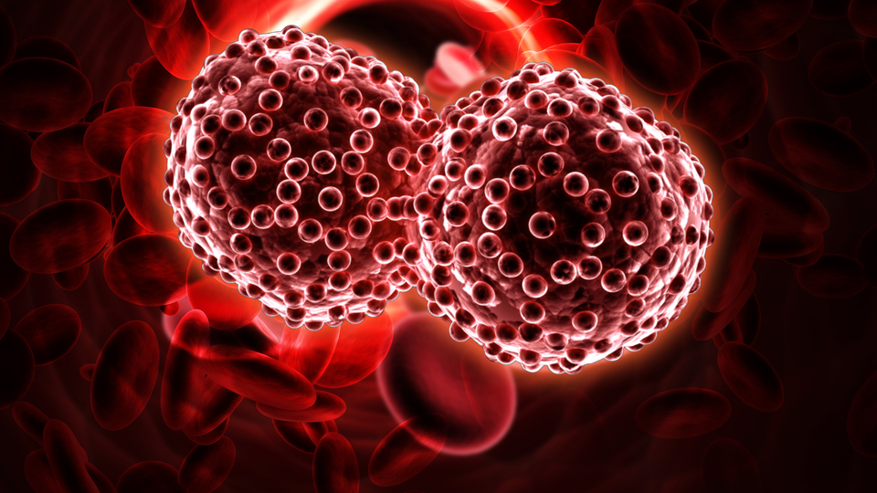 Teşhisi de tedavisi de en zor olan kanser!