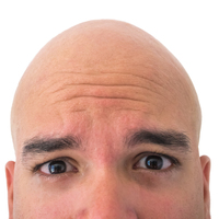 "Bilim insanları kelliğe çare buldu"