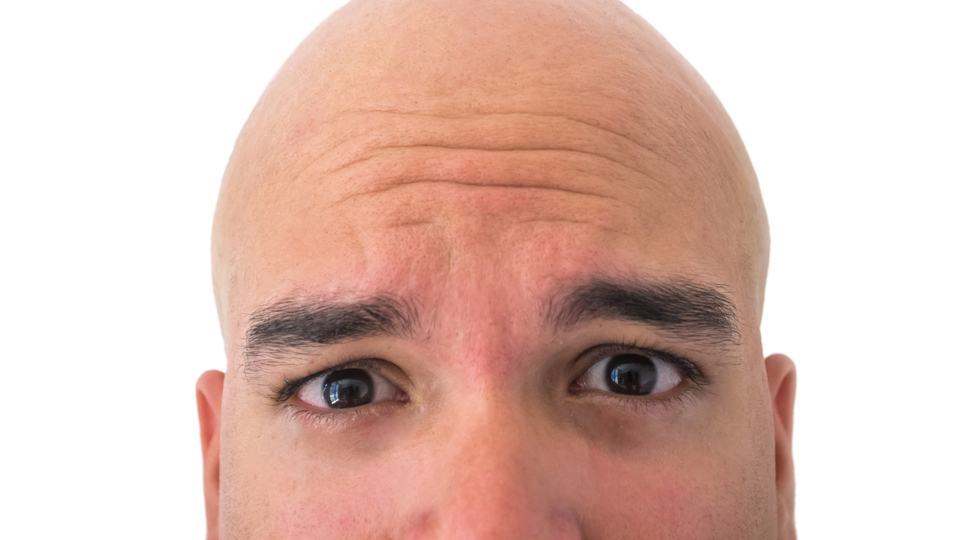 "Bilim insanları kelliğe çare buldu"