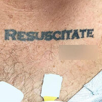 Doktorların zor kararı... Tam müdahale edecekken o dövmeyi gördüler!