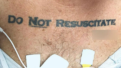 Doktorların zor kararı... Tam müdahale edecekken o dövmeyi gördüler!