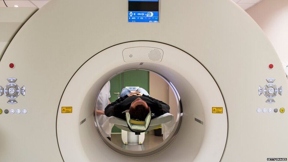 Dünyada yüz kişide görülen hastalık: Yaşayan ölü sendromu