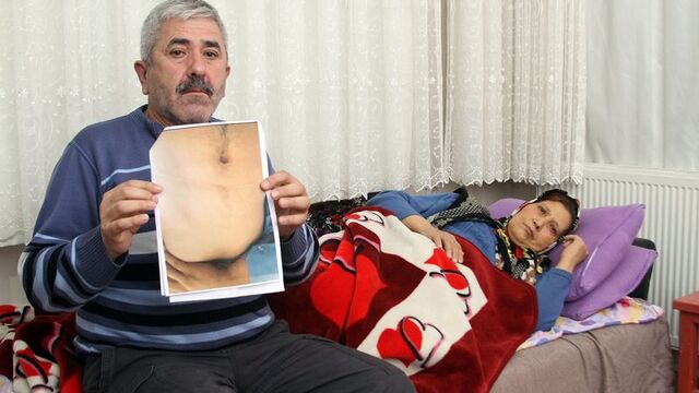 Bir garip nakil uyumsuzluğu hikayesi...