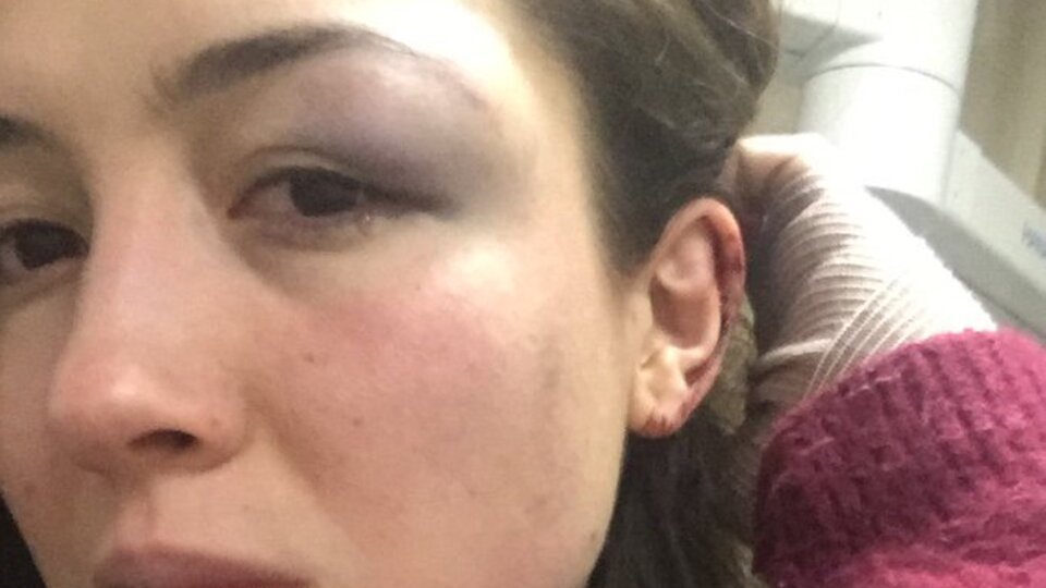 ''Demir çubukla dayak yedim''