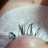 5 yıl boyunca yastık kılıfını değiştirmedi, korkunç gerçeği doktorda öğrendi!