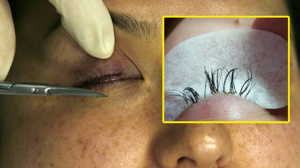 5 yıl boyunca yastık kılıfını değiştirmedi, korkunç gerçeği doktorda öğrendi!