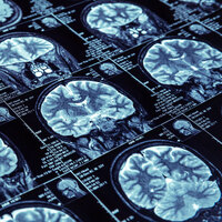 Yavuz Yılmaz'ın hastalığı neydi?