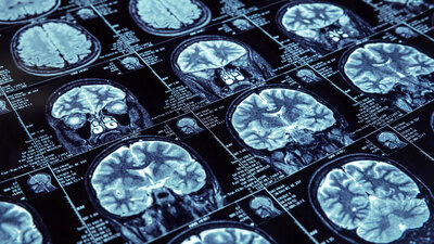 Yavuz Yılmaz'ın hastalığı neydi?