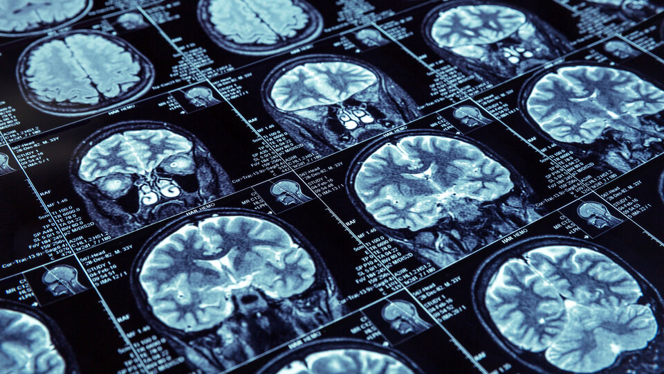 Yavuz Yılmaz'ın hastalığı neydi?