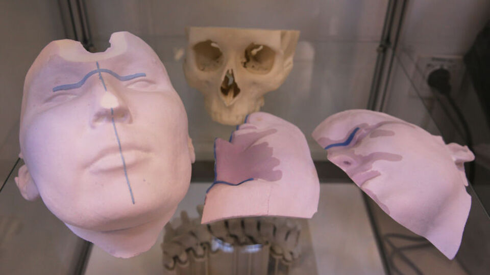 Kanser cerrahisinde "3D" teknolojisi