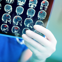 Temporal lob epilepsisi, beynin duyguları kontrol eden bölümünü etkiliyor!