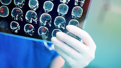 Temporal lob epilepsisi, beynin duyguları kontrol eden bölümünü etkiliyor!