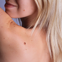 Benlerde görülen 5 tehlikeli değişiklik! Benin üstünde bunlar varsa...