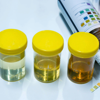 Dikkat eğer idrar renginiz böyleyse...