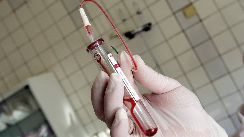 HIV pozitif hastanın tedavisi tartışması: 'HIV ahlaki değil, tıbbi bir durumdur'