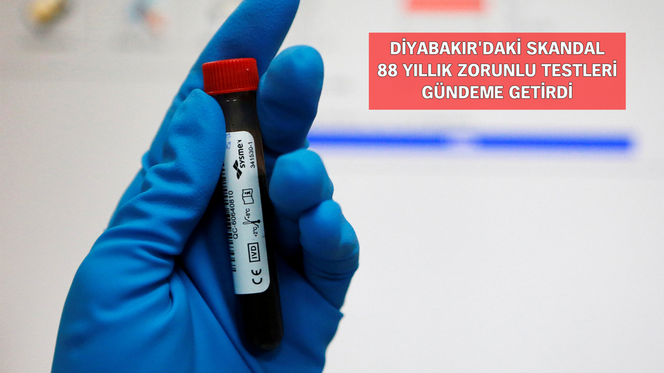 Zorunlu HIV testi tartışması