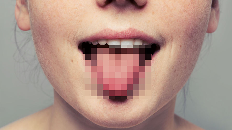 Dilden çıkan kıllar bakın neyin habercisi!