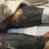 Dikkat sizin de başınıza gelebilir... Pişirmeden yedi, sonrası dehşet!