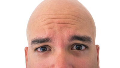 Dikkat saç ektirirken sağlığınızdan olmayın!