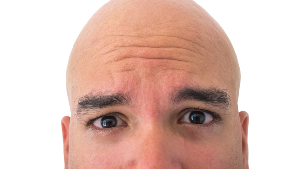 Dikkat saç ektirirken sağlığınızdan olmayın!