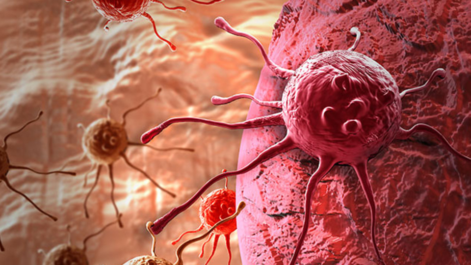 Her gün 450 kişiye kanser teşhisi konuluyor!