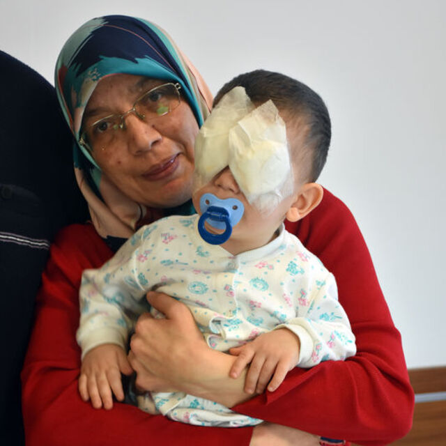 Bebeğin gözleri bacağından alınan dokuyla açıldı