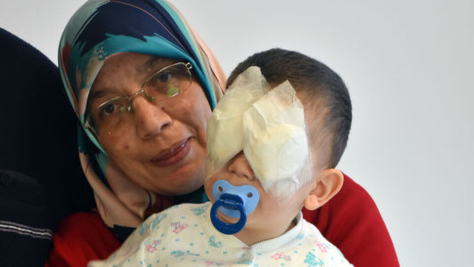 Bebeğin gözleri bacağından alınan dokuyla açıldı