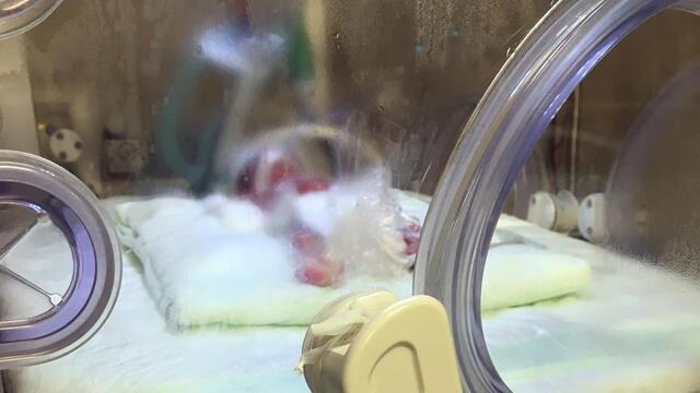 310 gram doğan bebek yaşam savaşı veriyor