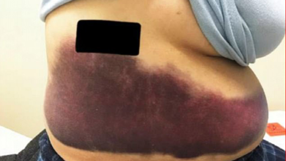 Dikkat sizin de başınıza gelebilir... Bu hale gelince gerçek ortaya çıktı!