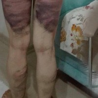 Cani koca: 4-5 kez vurmuş olabilirim, ama darp etmedim