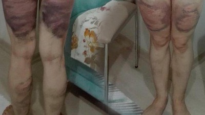 Cani koca: 4-5 kez vurmuş olabilirim, ama darp etmedim