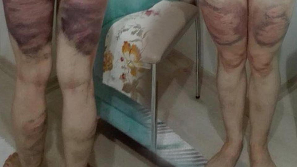 Cani koca: 4-5 kez vurmuş olabilirim, ama darp etmedim