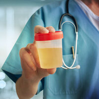 İdrar yaparken yanma oluyorsa dikkat!