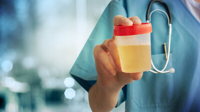 İdrar yaparken yanma oluyorsa dikkat!