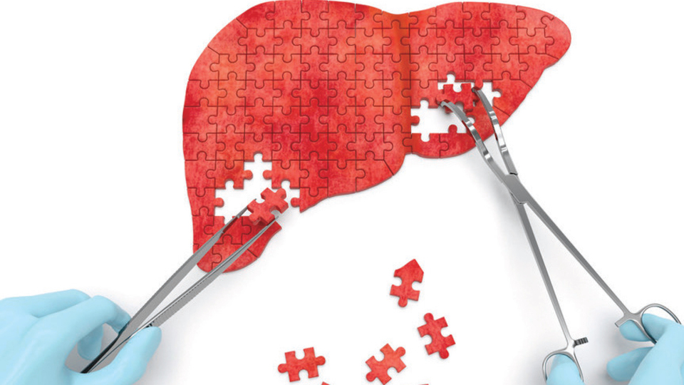 Tümöre yönelik radyasyon tedavisi