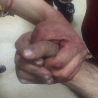 Afrin'de yaralanan askerlerin fotoğrafı gözleri yaşarttı