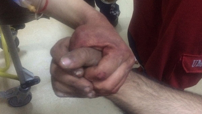 Afrin'de yaralanan askerlerin fotoğrafı gözleri yaşarttı