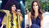 "Bülent Ersoy'un yüzü tanınmaz hale geldi"